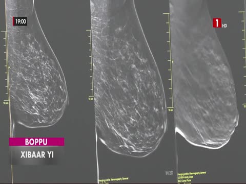 XIBAAR YI du mercredi 08 avr. 2026